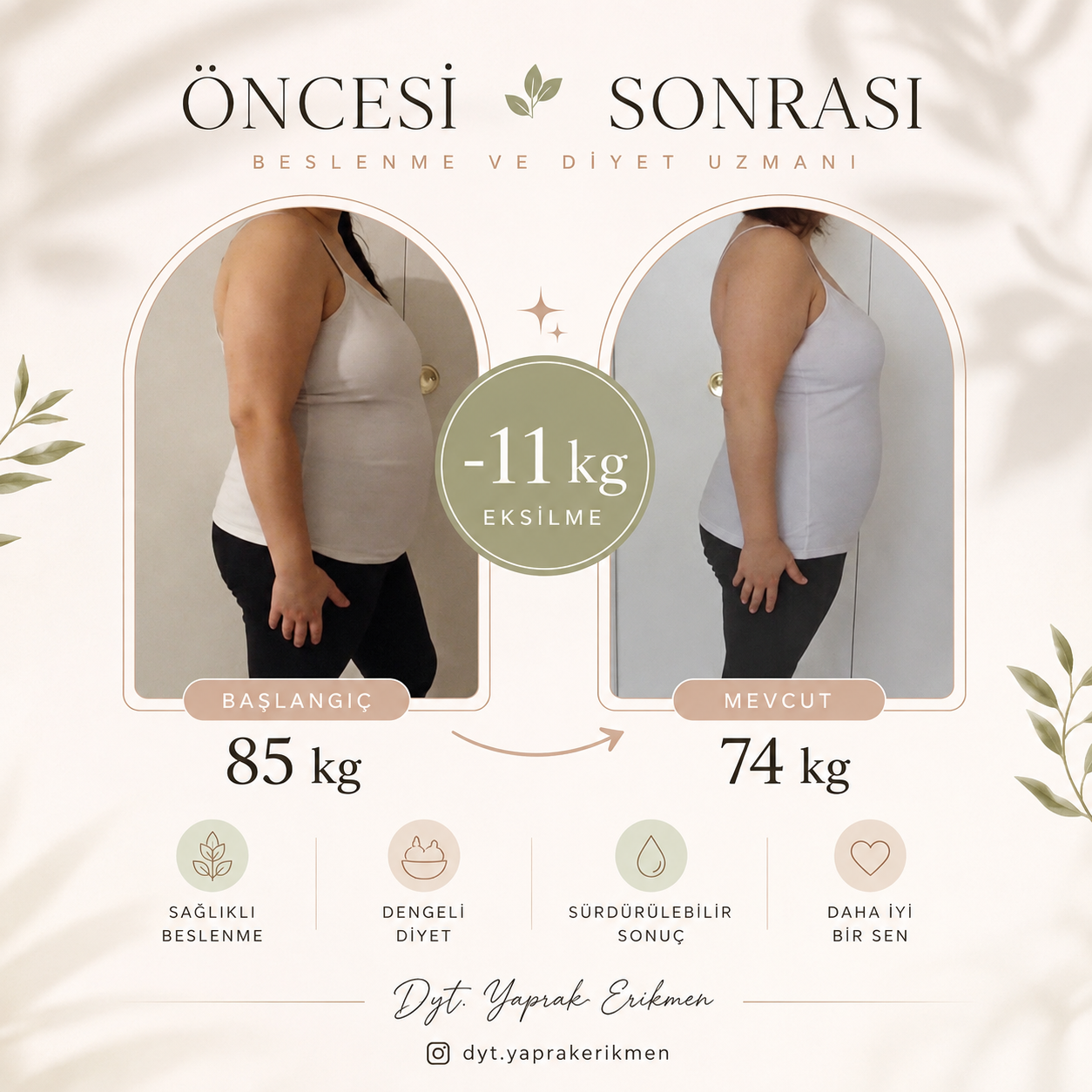 Vorher-Nachher-Ergebnis mit einer Gewichtsveränderung von 85 auf 74 kg